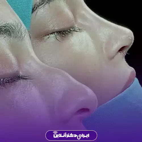 عمل بینی قلمی چگونه انجام می‌شود
