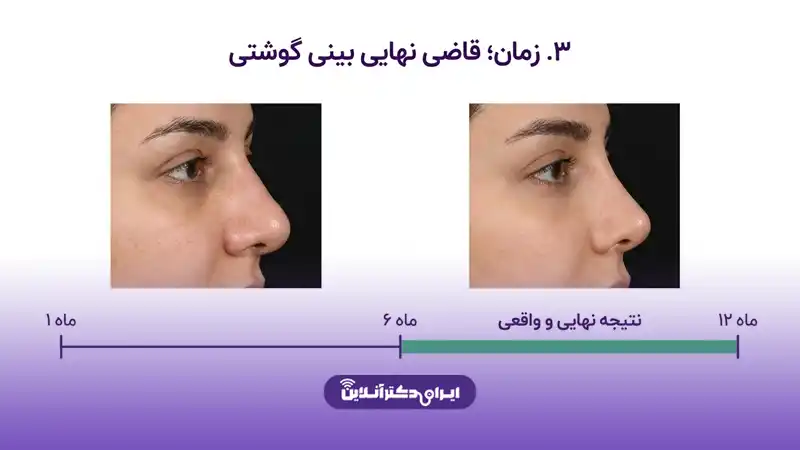 به نتیجه چند ماه بعد از عمل توجه کنید