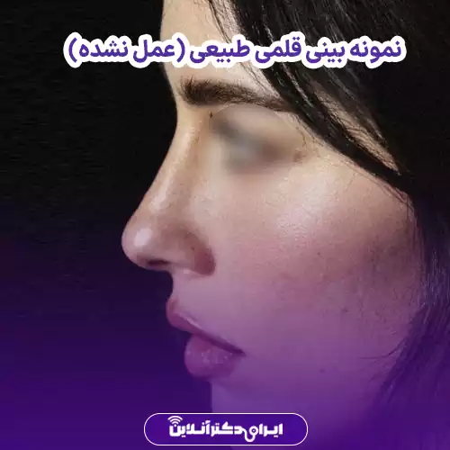 ویژگی‌های ظاهری بینی قلمی