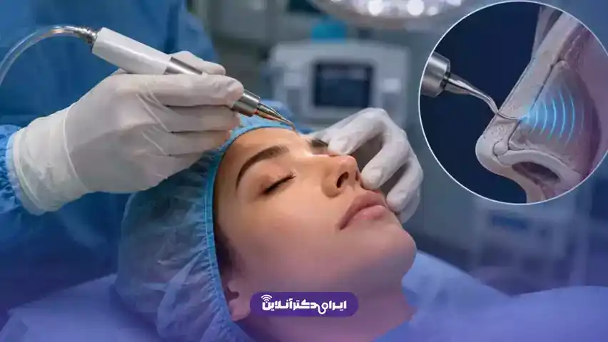 رفع قوز بینی با لیزر؛ لیزر قوز بینی واقعیت دارد؟ 7 رینوپلاستی؛ تنها روش دائمی برای برداشتن قوز بینی
