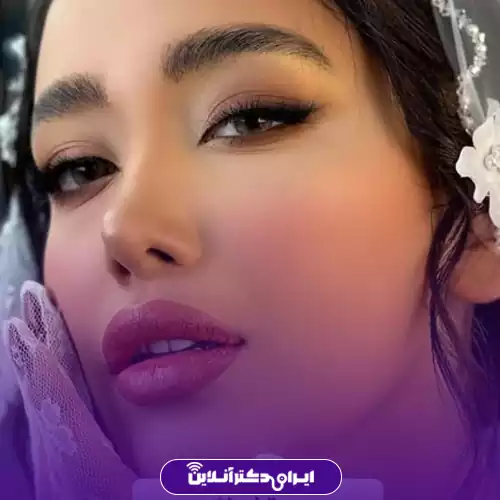 نمونه کار جراحی بینی دکتر عبدالمجید کثیری 3