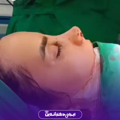 نمونه کار جراحی بینی دکتر عبدالمجید کثیری 4