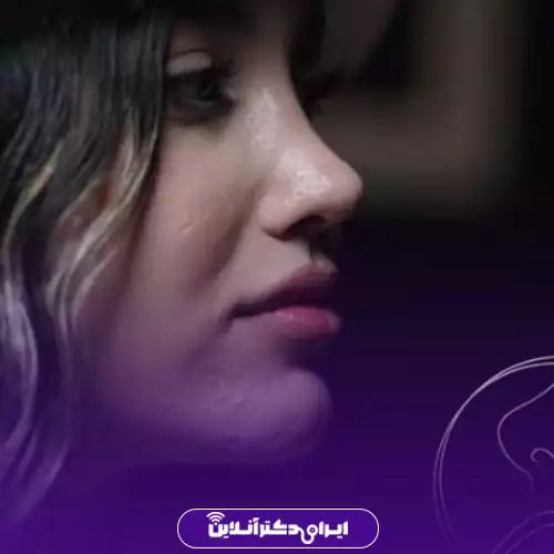 نمونه کار جراحی بینی دکتر سعید نجفی ثانی 2