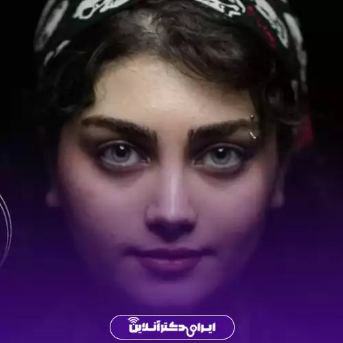 نمونه کار جراحی بینی دکتر سعید نجفی ثانی 3