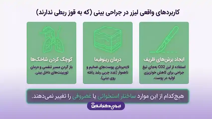 رفع قوز بینی با لیزر؛ لیزر قوز بینی واقعیت دارد؟ 5 نقش واقعی لیزر در جراحی بینی چیست؟