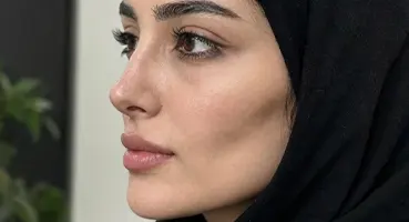 مدل بینی استخوانی قوز دار