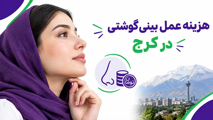 هزینه عمل بینی گوشتی در کرج
