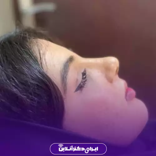 نمونه عمل بینی گوشتی دکتر عباس نوروزی
