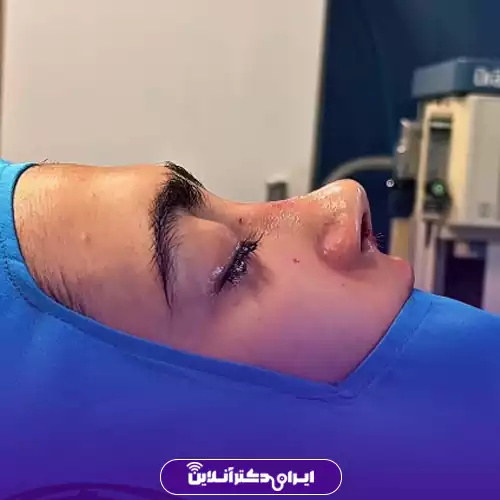 نمونه کار عمل بینی دکتر علیرضا مزارعی 4