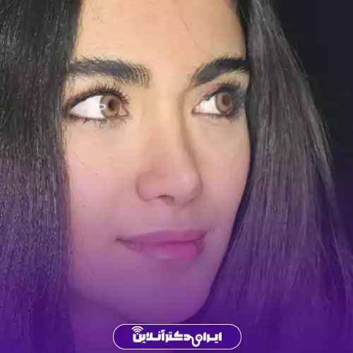 نمونه کار قبل و بعد عمل بینی سبک طبیعی در تهران توسط دکتر انصاری 4