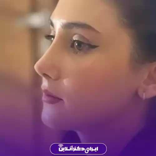 نیم‌رخ زیبای بینی پس از جراحی بینی استخوانی در اصفهان، نمونه کار دکتر آزاده کازرونی