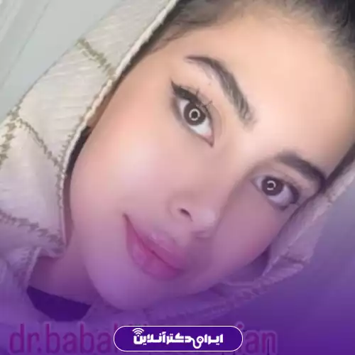 نمونه جراحی بینی طبیعی در تهران توسط دکتر بابک خسرویان 1