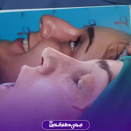 نمونه کار قبل و بعد جراحی بینی گوشتی خانم‌ها توسط دکتر فرید عطار