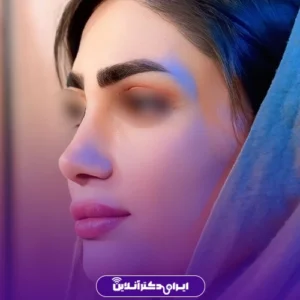 نمونه کار عمل بینی دکتر هادی سرمست 3