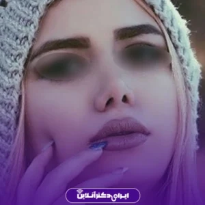 نمونه کار عمل بینی دکتر هادی سرمست5