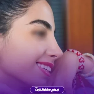 نمونه کار عمل بینی دکتر هادی سرمست 7