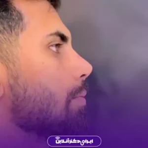 نمونه کار عمل بینی دکتر حمید نوری 1