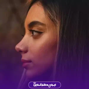 نمونه کار عمل بینی دکتر حمید نوری 6
