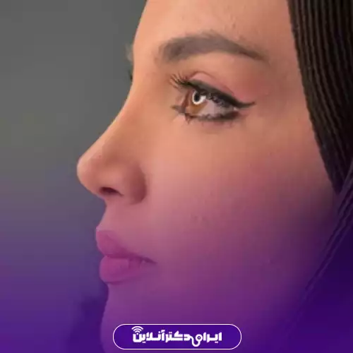نمونه کار نیم‌رخ جراحی بینی گوشتی خانم توسط دکتر حمیدرضا مفرد در کرج