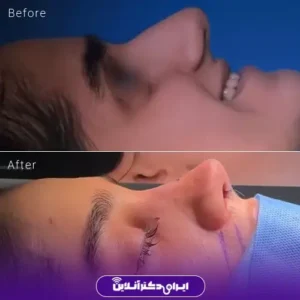 نمونه کار عمل بینی دکتر حمیدرضا نوری 2