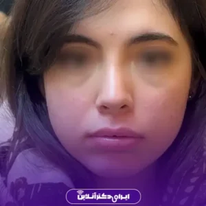 نمونه کار عمل بینی دکتر حمیدرضا نوری 4