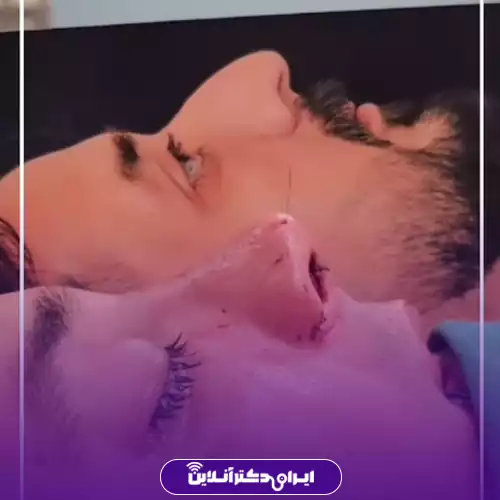 قبل و بعد عمل بینی استخوانی در اصفهان؛ عکس نیم‌رخ پیش از جراحی کنار صورت بیمار پس از عمل، دکتر ایمان محمدی