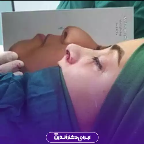 بیمار در اتاق عمل جراحی بینی استخوانی در اصفهان کنار عکس نیم‌رخ مرجع، دکتر جلال‌الدین شریعت
