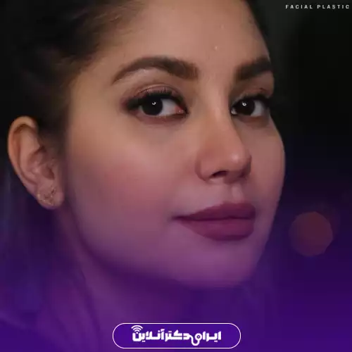 نمونه قبل و بعد جراحی بینی طبیعی تهران دکتر مجیدی 1