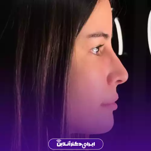 نمونه قبل و بعد جراحی بینی طبیعی تهران دکتر مجیدی 3