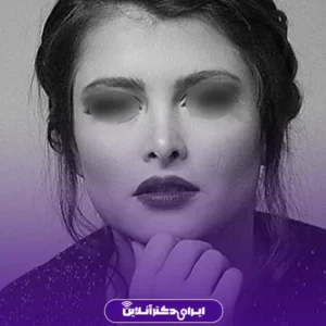 نمونه کار عمل بینی دکتر مسعود راستکاری 1