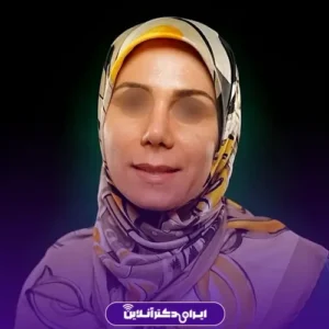 نمونه کار عمل بینی دکتر مسعود راستکاری 2