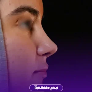 نمونه کار عمل بینی دکتر مسعود راستکاری 5