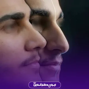نمونه کار عمل بینی دکتر مسعود راستکاری 6