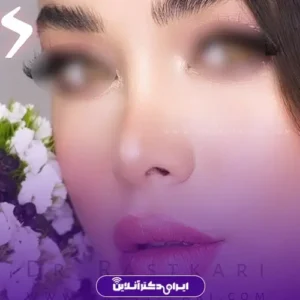 نمونه کار عمل بینی دکتر مسعود راستکاری 9