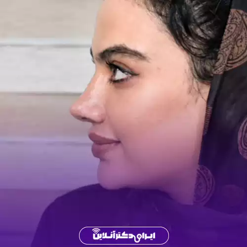 نمونه کار عمل بینی دکتر پریسا نظرپور 1