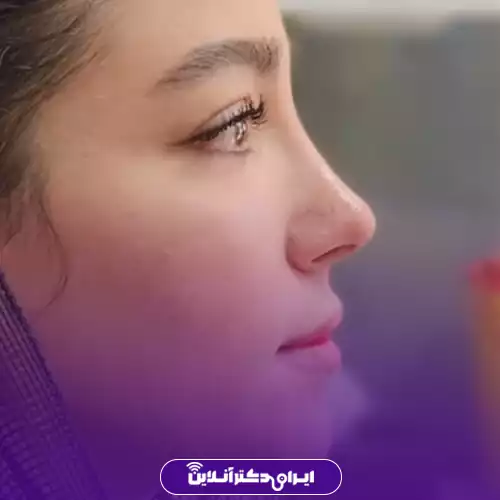 نمونه کار جراحی بینی سبک طبیعی توسط دکتر بشارتی زاده تهران 3