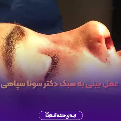 نمونه کار عمل بینی دکتر سونا سپاهی 3