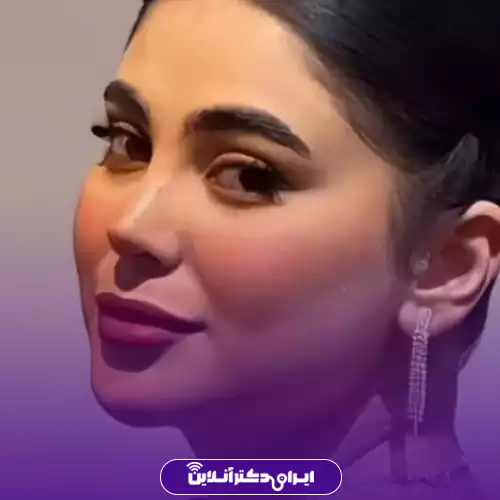 نمونه کار عمل بینی دکتر سونا سپاهی 4