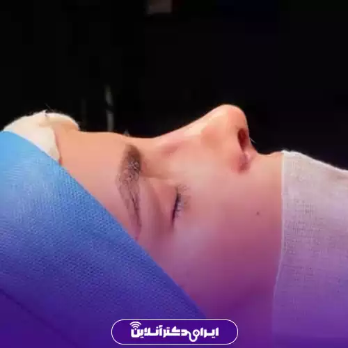 نمونه کار عمل بینی طبیعی دکتر وقردوست در شهر تهران 3