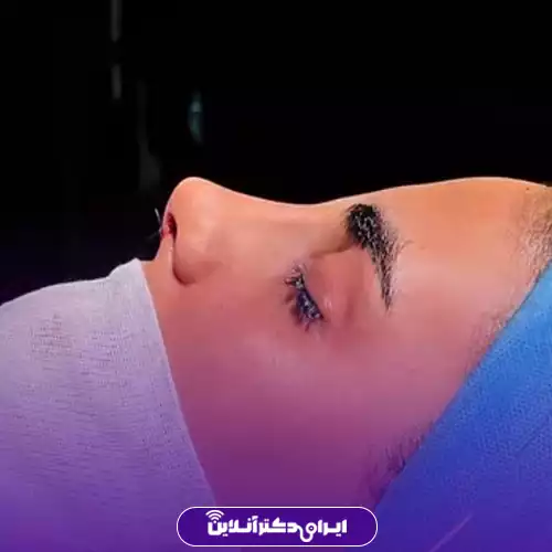 نمونه کار عمل بینی طبیعی دکتر وقردوست در شهر تهران 4