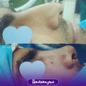 نمونه کار عمل بینی دکتر حمیدرضا فرجاد 10