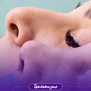 نمونه کار عمل بینی دکتر حمیدرضا فرجاد 5