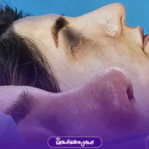 نمونه کار عمل بینی دکتر حمیدرضا فرجاد 6