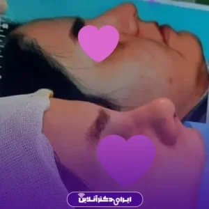 نمونه کار عمل بینی دکتر حمیدرضا فرجاد 8