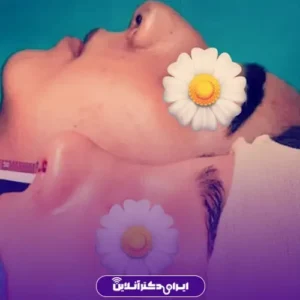 نمونه کار عمل بینی دکتر حمیدرضا فرجاد 9