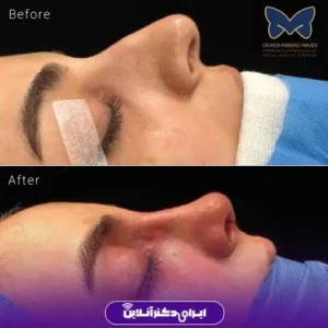 نمونه کار عمل بینی دکتر محمد مجیدی 10