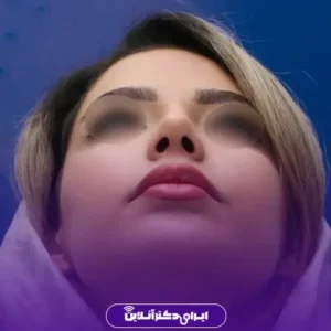 نمونه کار عمل بینی دکتر محمد مجیدی 2