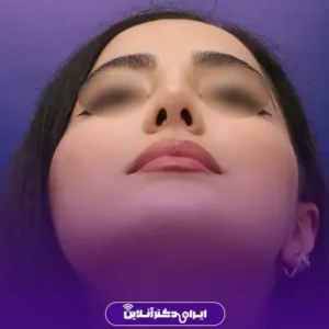 نمونه کار عمل بینی دکتر محمد مجیدی 3