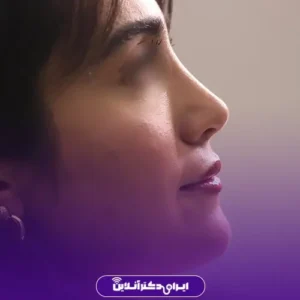 نمونه کار عمل بینی دکتر محمد مجیدی 4