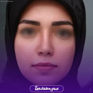 نمونه کار عمل بینی دکتر محمد مجیدی 5